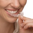 Invisalign