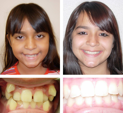 Before and after treatment photos of a patient