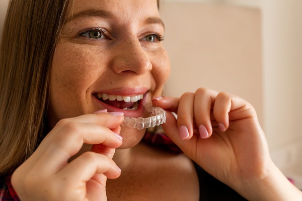 Clear Aligners: Tips For Beginners