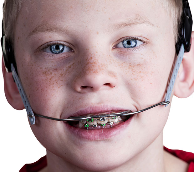 Los Angeles Orthodontic Headgear