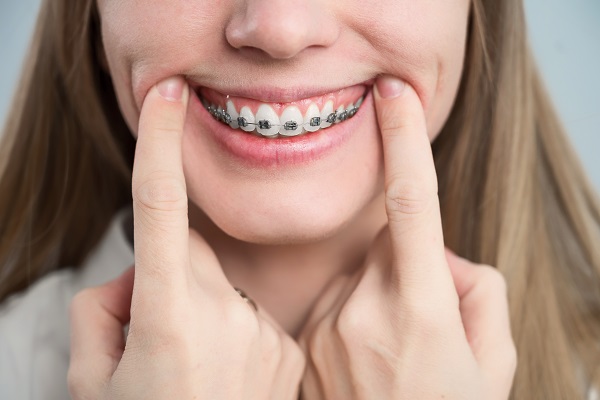 The Benefits Of Phase One Orthodontics For Early Treatment