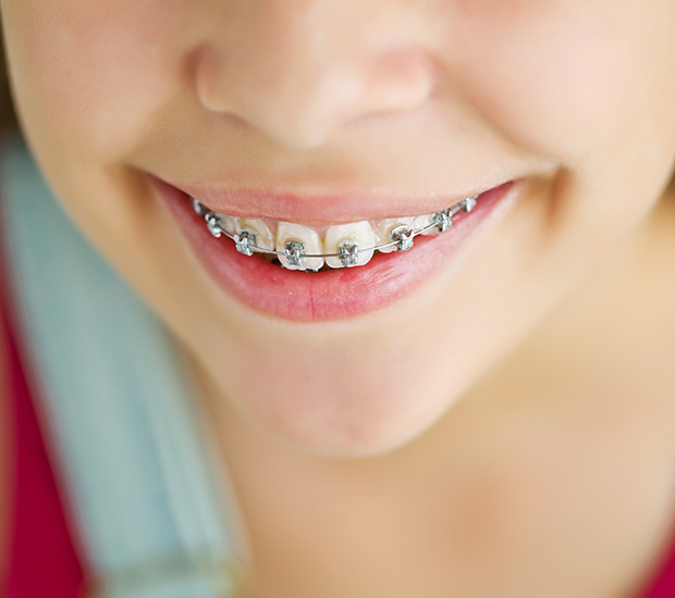 Los Angeles Phase Two Orthodontics