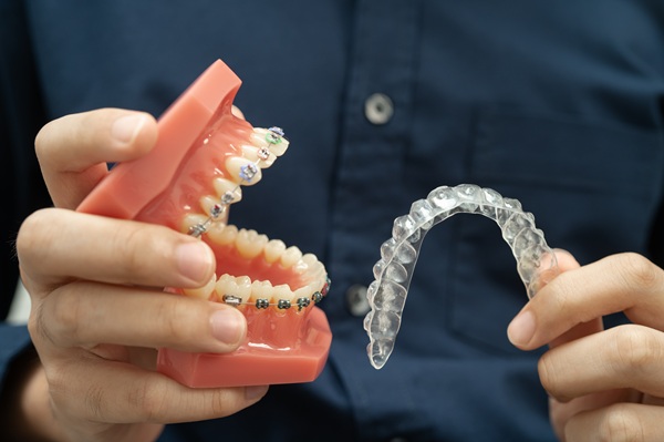 Achieve Your Dream Smile With Expert Teeth Straightening Services